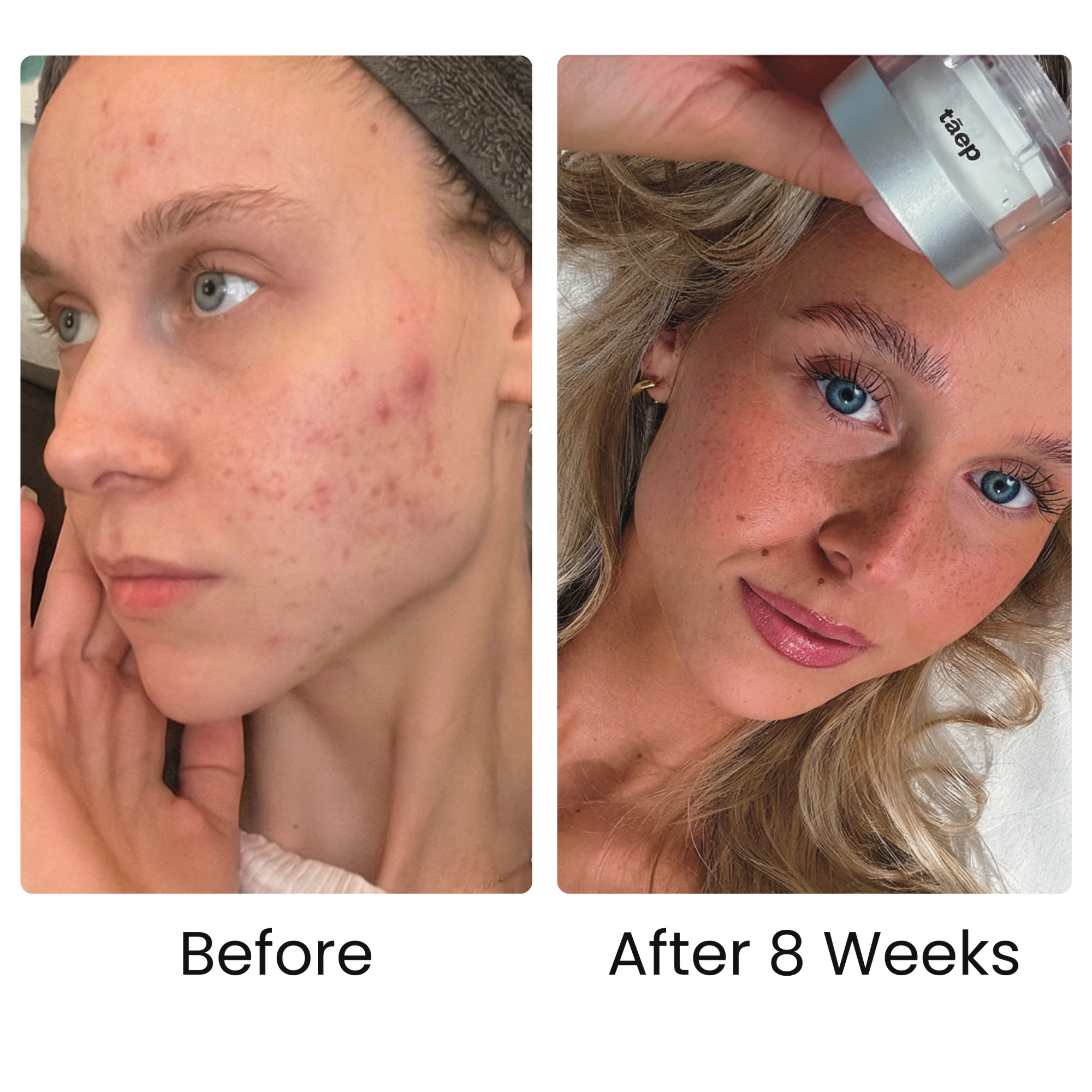 Feel the difference on your skin.